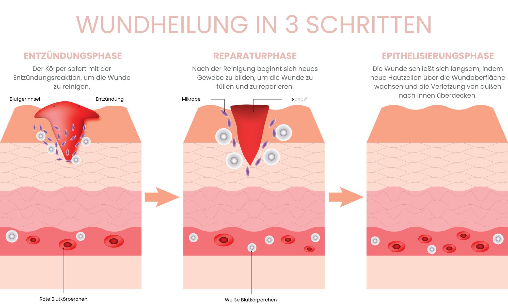 Die Infografik zeigt die natürlichen Phasen der Hautregeneration von der Entzündungsreaktion über den Zellaufbau bis zur vollständigen Erholung und Stabilisierung der Hautbarriere.